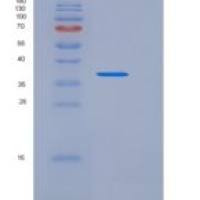 人FAM171B / KIAA1946重组蛋白His tag