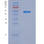 人Layilin / LAYN重组蛋白Fc tag