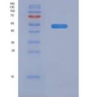 人Layilin / LAYN重组蛋白Fc tag