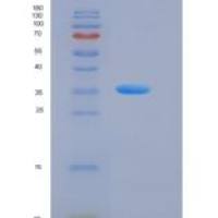 小鼠Follistatin / FST重组蛋白His tag