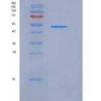 人NCKIPSD / SPIN90重组蛋白GST tag