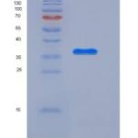 人APEX1 / AP / APEx / Ref-1重组蛋白His tag