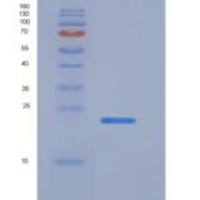 大鼠LTBR / TNFRSF3重组蛋白His tag