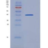 小鼠CD79A /免疫球蛋白-α重组蛋白ECD, Fc tag
