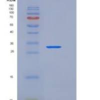 小鼠分泌型卷曲相关蛋白2(SFRP2)重组蛋白His tag