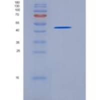 人SerpinA7 / TBG重组蛋白His tag