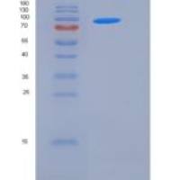 人STXBP3 / UNC-18C重组蛋白His & GST tag