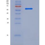 人亮氨酸丰富α2-糖蛋白1(LRG1)重组蛋白Fc tag