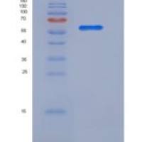 人亮氨酸丰富α2-糖蛋白1(LRG1)重组蛋白Fc tag