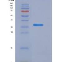 人CALCB重组蛋白Fc Tag