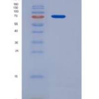 小鼠乳铁传递蛋白(LTF)重组蛋白His tag