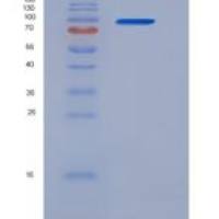 人ERP72 / PDIA4重组蛋白Fc ta