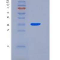 人亮氨酸丰富α2-糖蛋白1(LRG1)重组蛋白His tag