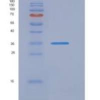 人跳跃易位断点/ JTB重组蛋白Fc tag
