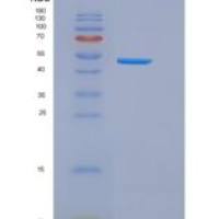 人CD50 / ICAM-3重组蛋白His tag