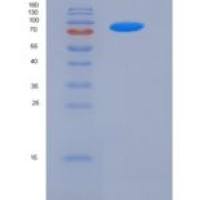 人FSTL5重组蛋白His tag