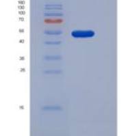 人PNLIPRP1 / PLRP1重组蛋白His tag