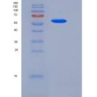 人斯钙素2(STC2)重组蛋白Fc tag