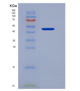 人SUSD4 /含Sushi结构域的蛋白4重组蛋白Fc ta