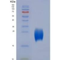大鼠CD63 / Tspan-30 / Tetraspanin-30重组蛋白Fc tag
