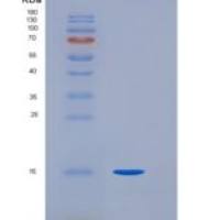 人SELM /硒蛋白M重组蛋白His tag