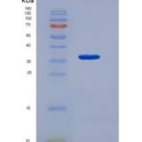 人CD3d / CD3 delta重组蛋白Fc & FLAG tag