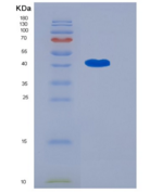 人OMGP / OMG重组蛋白aa 1-420, His t