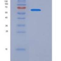 人WFIKKN2 / GASP-1重组蛋白His tag