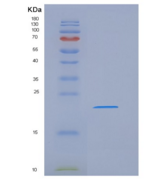 人TMEM25重组蛋白His tag