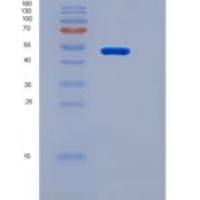 大鼠CD8A / Lyt2重组蛋白Fc tag