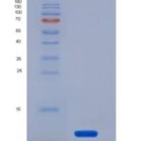 人FKBP12重组蛋白His tag