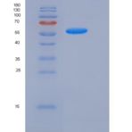小鼠Follistatin / FST (FS288)重组蛋白Fc tag
