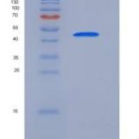 人细胞周期蛋白E1重组蛋白