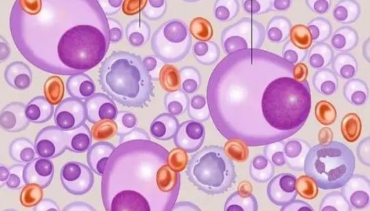 多发性骨髓瘤的两种皮下移植瘤动物模型的构建