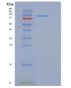 人NEL样蛋白2(NELL2)重组蛋白His tag