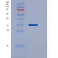 人钙黄绿素(Calumenin)重组蛋白His Tag