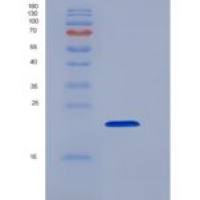 大鼠CLEC4A2 / DCIR重组蛋白His tag