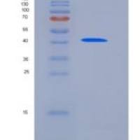 大鼠CD79B / B29重组蛋白Fc tag