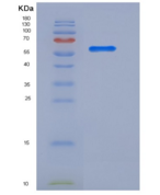 人亮氨酸丰富α2-糖蛋白1(LRG1)重组蛋白Fc tag