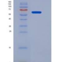 小鼠IL-1R8 / IL1RAPL1重组蛋白Fc tag