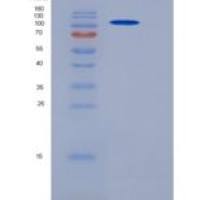 小鼠PARP-1 / PARP重组蛋白His tag