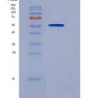 大鼠CD133 / PROM1 / Prominin 1重组蛋白Fc tag