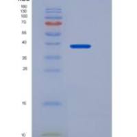 人白介素13受体α1(IL13Ra1)重组蛋白His Tag