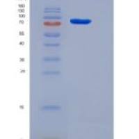 人RACK1 / GNB2L1重组蛋白His & MBP tag