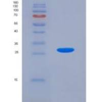 人集钙蛋白(CASQ)重组蛋白