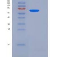 人彩斑4-20同源物1抑制因子2(SUV420H2)重组蛋白His & GST tag