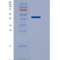 人SerpinE1 / PAI-1重组蛋白His tag