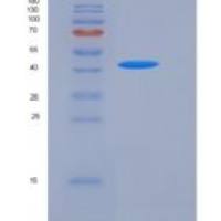 人CD8 beta重组蛋白Fc Tag