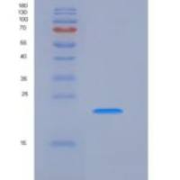 人Bcl2修正因子(BMF)重组蛋白His tag