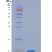小鼠CD59a / Protectin / MAC-IP重组蛋白His tag